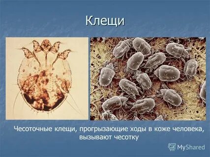 Чесоточный зудень клещ