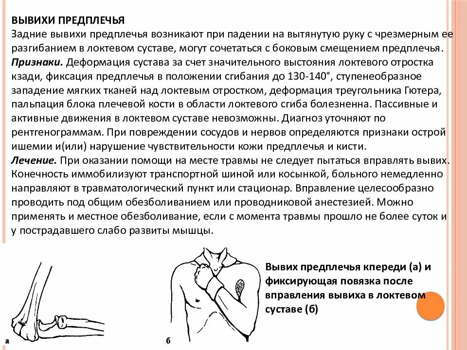 Лечение предплечья. Правление вывиха локтевой кости. Вывих локтевого сустава у детей симптомы. Вправление вывиха локтевого сустава. Вправление вывиха предплечья.