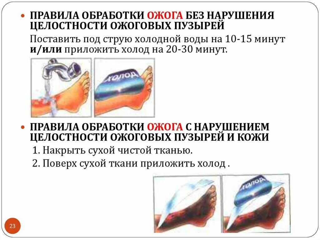 Правило обработки ожога без нарушения целостности пузырей. Ожоги кожного Покрова при нарушении целостности ожоговых пузырей. Обработка ожога с нарушением целостности пузырей. Правила обработки ожога без нарушения целостности ожоговых пузырей. Правила обработки ожога с нарушением целостности ожоговых пузырей.