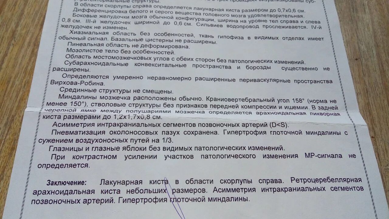 Лакунарные кисты в головном мозге. Киста головного мозга заключение. Лакунарная ликворная киста. Кисты в области базальных ядер головного мозга.