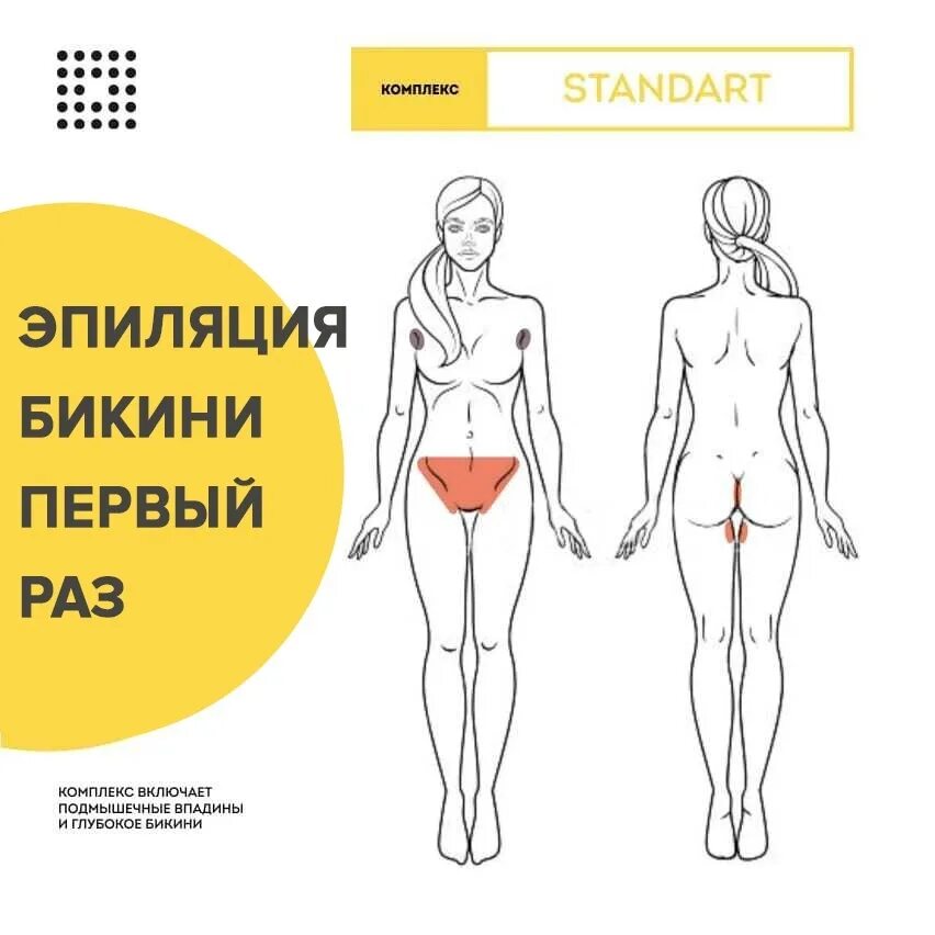 Тотальное бикини что это. Зоны эпиляции. Зона эпиляции классическое бикини. Тотальная эпиляция зоны бикини. Тотальное бикини и классическое бикини.