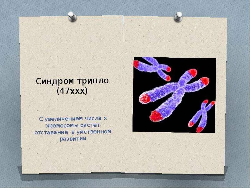 Синдром трипло-х презентация. Синдром трипло-х. С трипло х рисунок. Трипло х феторип. Фото трипло