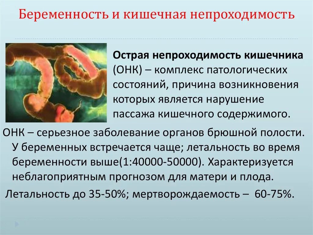 Острая кишечная непроходимость. Острая непроходимость кишечника. Острая кишечная непроходимость у беременных. Острая кишечная непроходимость причины. Нарушение пассажа