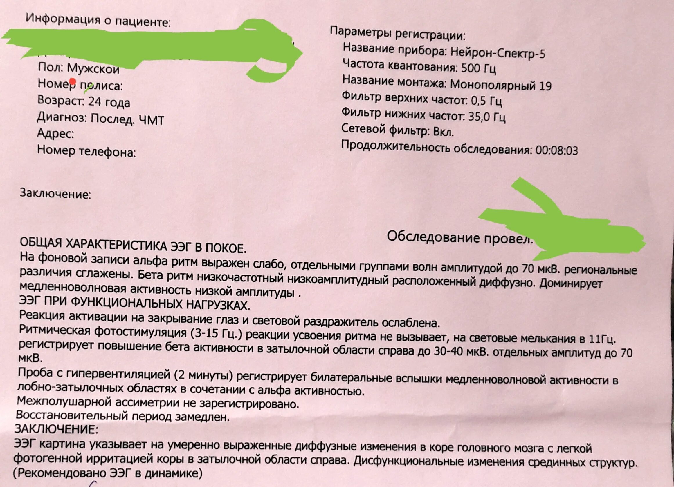 Медленноволновая активность на ЭЭГ. Диффузная медленноволновая активность. Медленноволновая активность головного мозга это. Повышение индекса МЕДЛЕННОВОЛНОВОЙ активности.