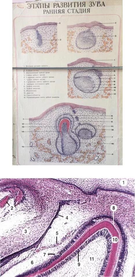 Стадии развития зуба. Эмалевый орган гистология препарат. Гистогенез зуба гистология. Зачаток зуба гистология. Стадия закладки зубного зачатка гистология.