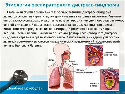 Острый респираторный дистресс