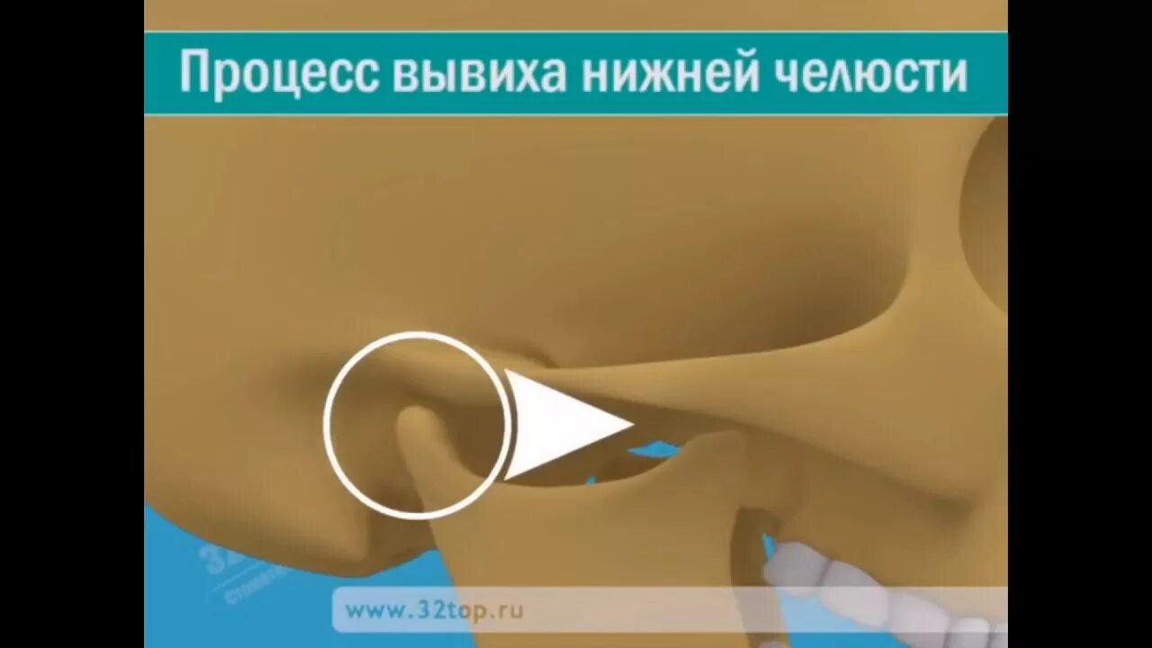 Что делать если заклинило челюсть