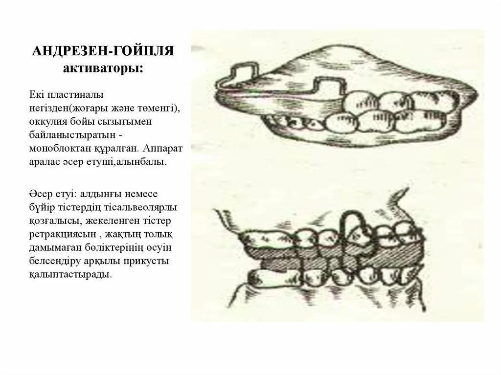 Аппарат (активатор) Андрезена-Гойпля. Моноблока активатора Андрезена-Гойпля. Активатор Андрезена-Гойпля. Закрытый активатор Андрезена Гойпля. Активатор андрезена