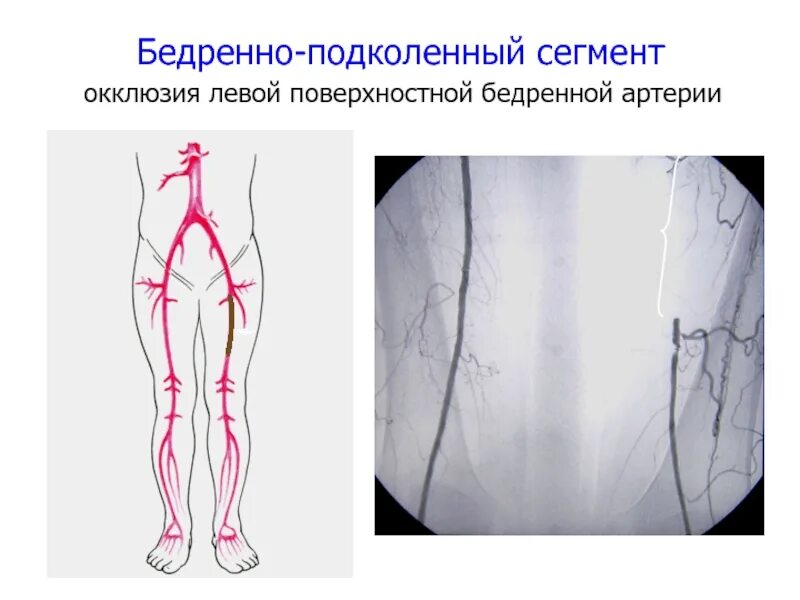 Сегменты нижних конечностей
