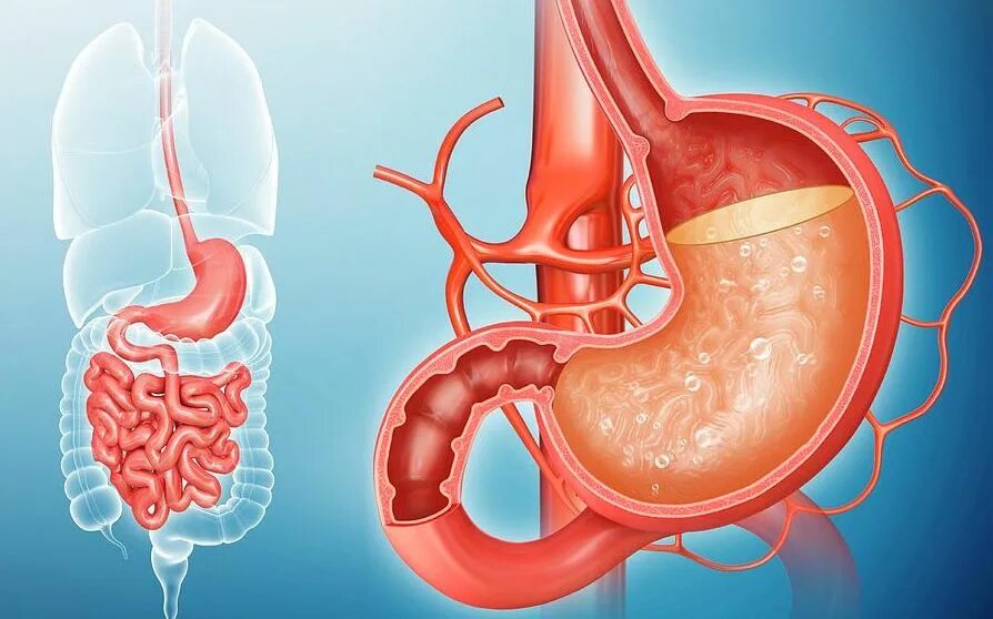 Повышенная кислотность желудка сока. Гастродуоденит артерия. Желудок с соляной кислотой.