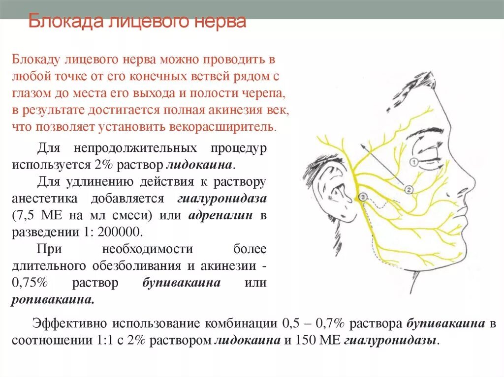 Нервная блокада. Схема блокады ветвей тройничного нерва. Техника блокады ветвей тройничного нерва. Схема блокады тройничного нерва. Блокада 3 ветви тройничного нерва анестезия.