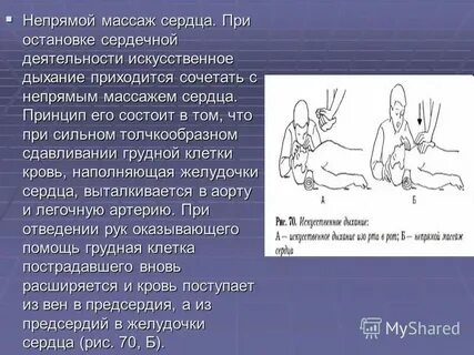 Темп непрямого массажа сердца в минуту