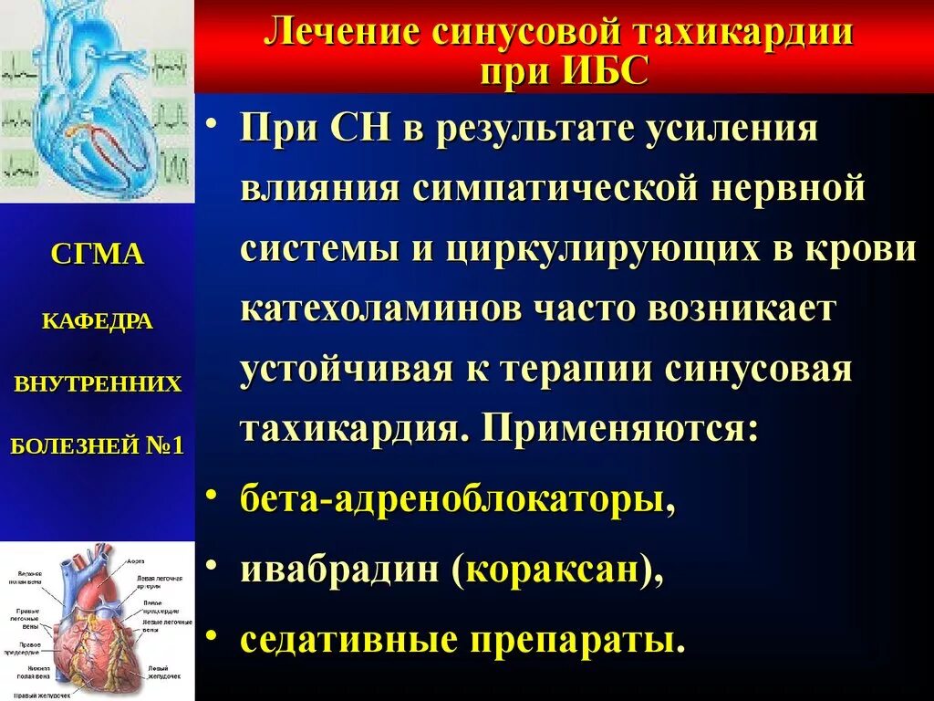 Лекарства при синусовой тахикардии. Препарат при тахикардии стенокардии. Лекарство от синусовой тахикардии сердца. Стенокардия и тахикардия лекарства.