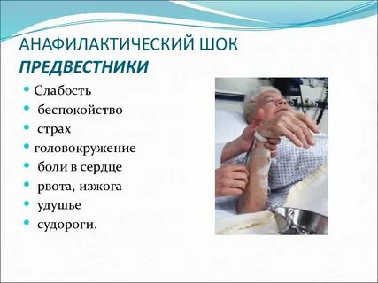 Аллергический шок