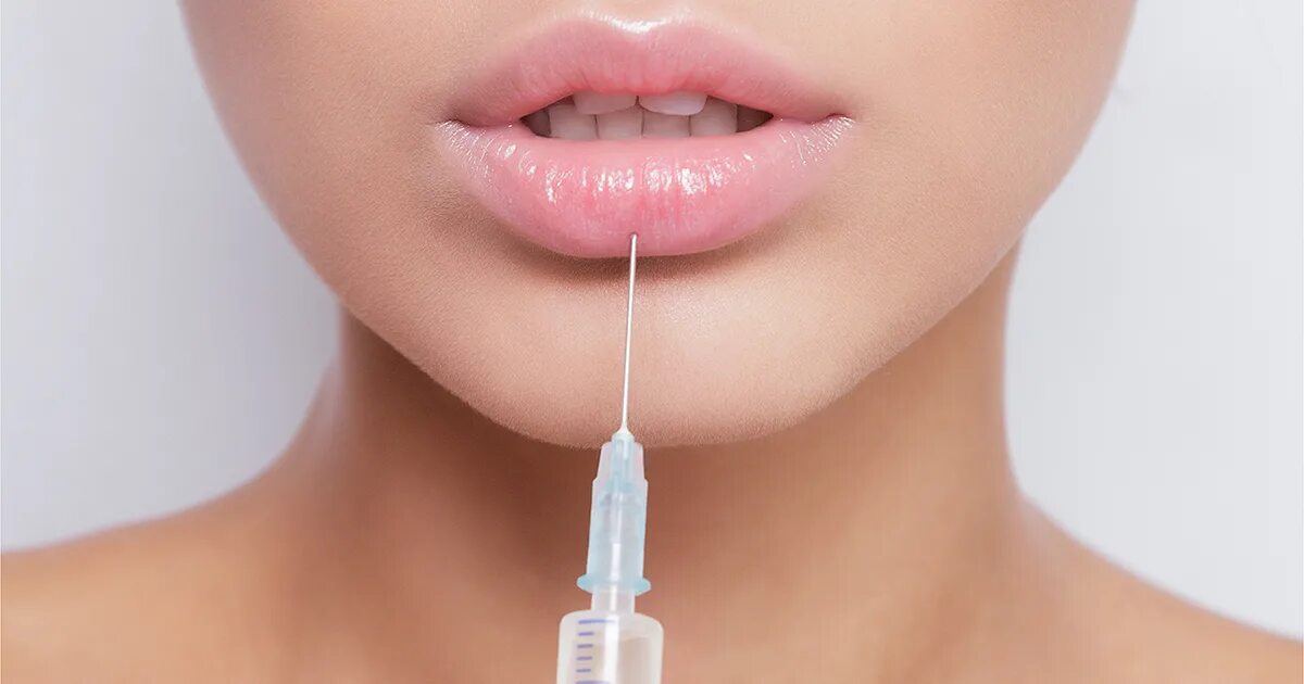 Контурная пластика. Контурная пластика. Губы гиалуроновой кислотой. Контурная пластика губ гиалуроновой. Инъекционная косметология.