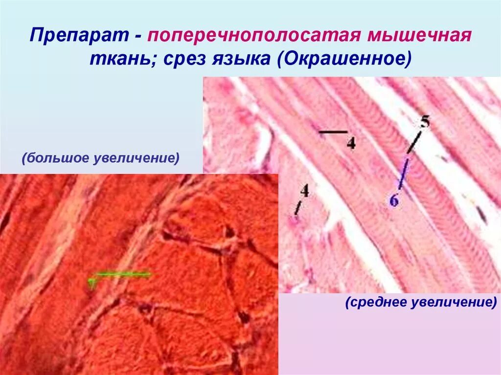 Поперечно полосатая Скелетная мышечная ткань гистология препарат. Скелетная мышечная ткань гистология препарат. Поперечно полосатая сердечная препарат. Мышечная ткань языка гистология. Препарат поперечно полосатая мышечная ткань