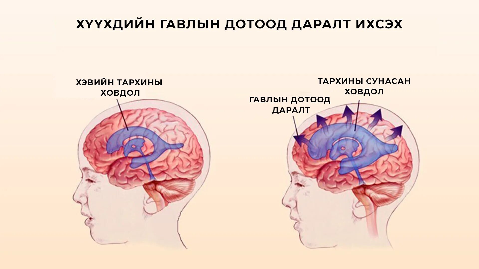 Внутричерепное давление головного мозга