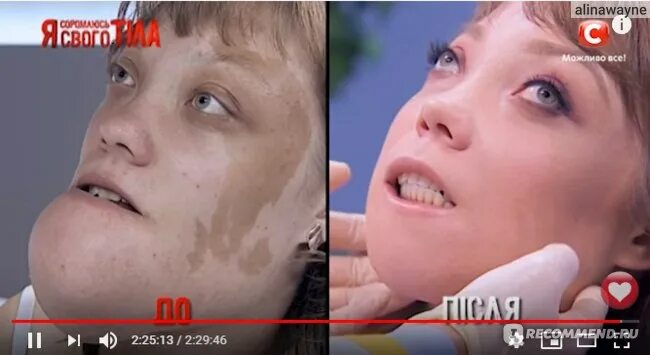 Программа ю я стесняюсь своего тела. Я стесняюсь своего тела. я стесняюсь своего телала. я стесняюсь своего до и после.