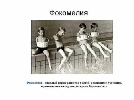 Тяжелый порок