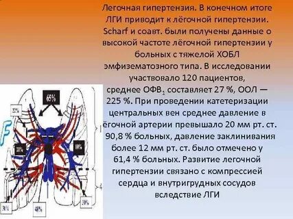 Живу с легочной гипертензией