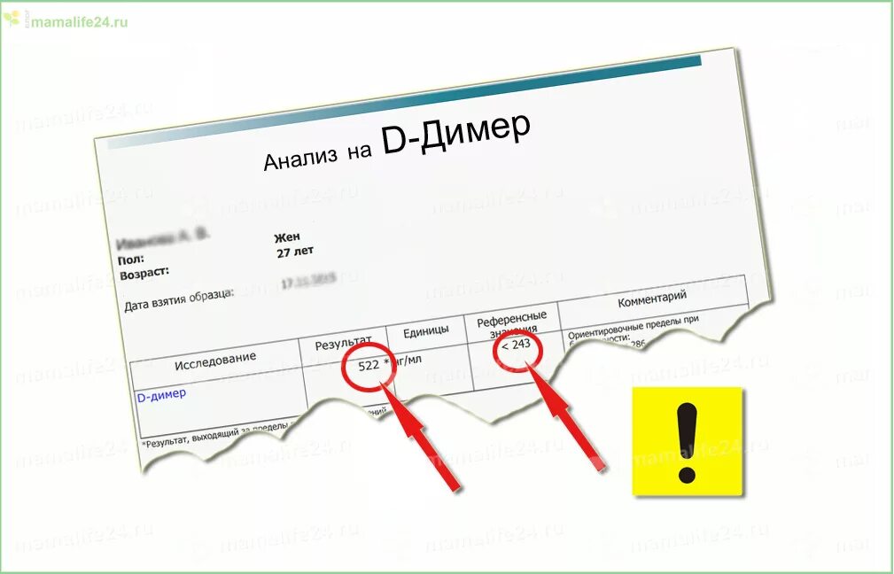 Дата 04.04 2024 что значит. Показания к исследованию д-димер. Анализ д димера. Д димер 0.17. Направление анализа крови д димера.