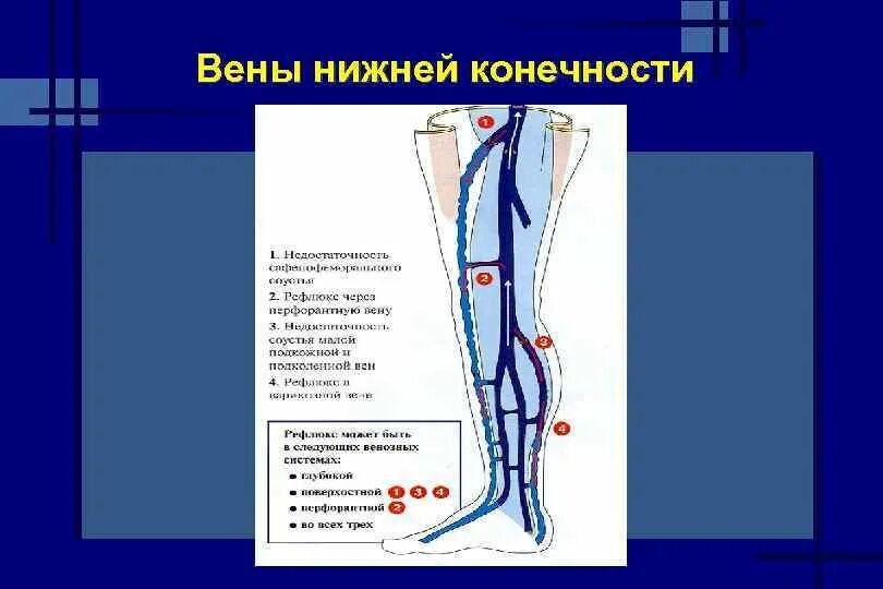 Тромбоз бпв. Вены нижних конечностей схема. Вены нижних конечностей анатомия схема. Поверхностные вены нижней конечности схема. Поверхностные (подкожные) вены нижней конечности:.