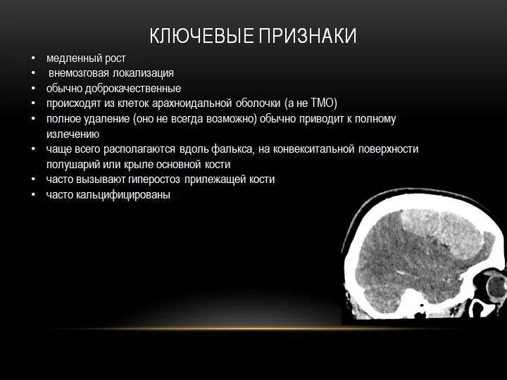 Признаки головной опухоли. Начальные признаки опухоли головного мозга. Опухоль головного мозга симптомы. Новообразование в головном мозге симптомы у взрослых. Есть рак головы