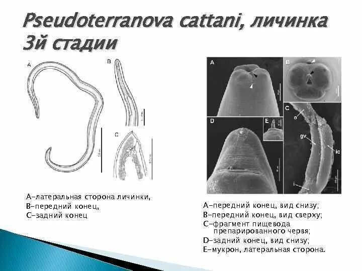 3 й стадии. Личинки нематод рода Anisakis. Анизакидоз морфология. Анизакидоз жизненный цикл.