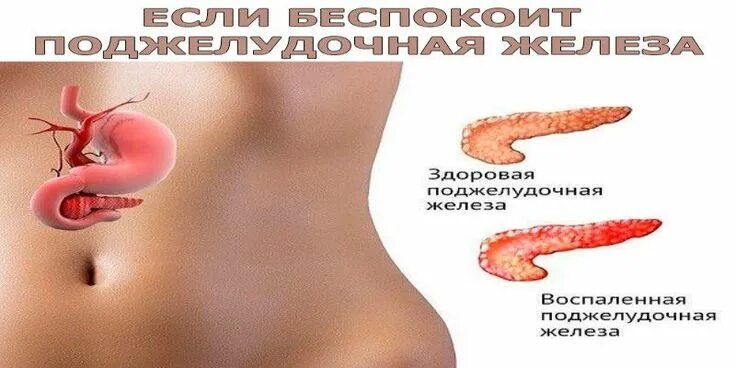Как лечат патологию поджелудочной железы?