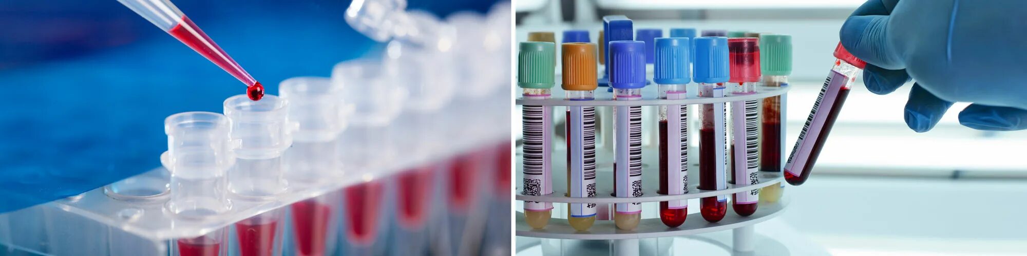 ветеринария анализы. переливание крови собаке. взятие крови у кошек и собак. взятие крови у животного. исследование ветеринария.