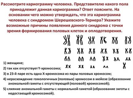 Представителю какого пола принадлежит данная кариограмма