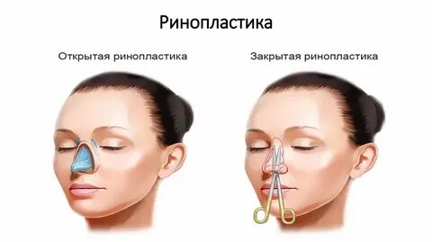 Холодный нос что это значит. Холодный нос что это значит. Холодный нос у человека причины. Холодный нос что это значит. Формы носа.