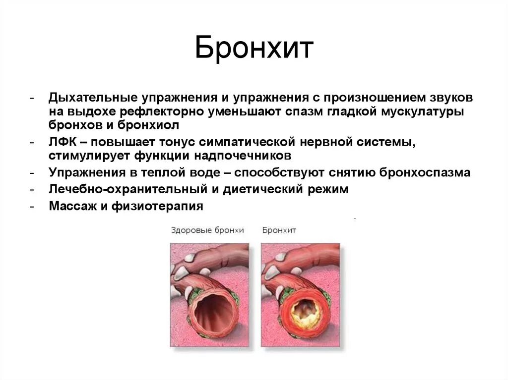 Бронхит сопли. Спазм гладкой мускулатуры бронхов.