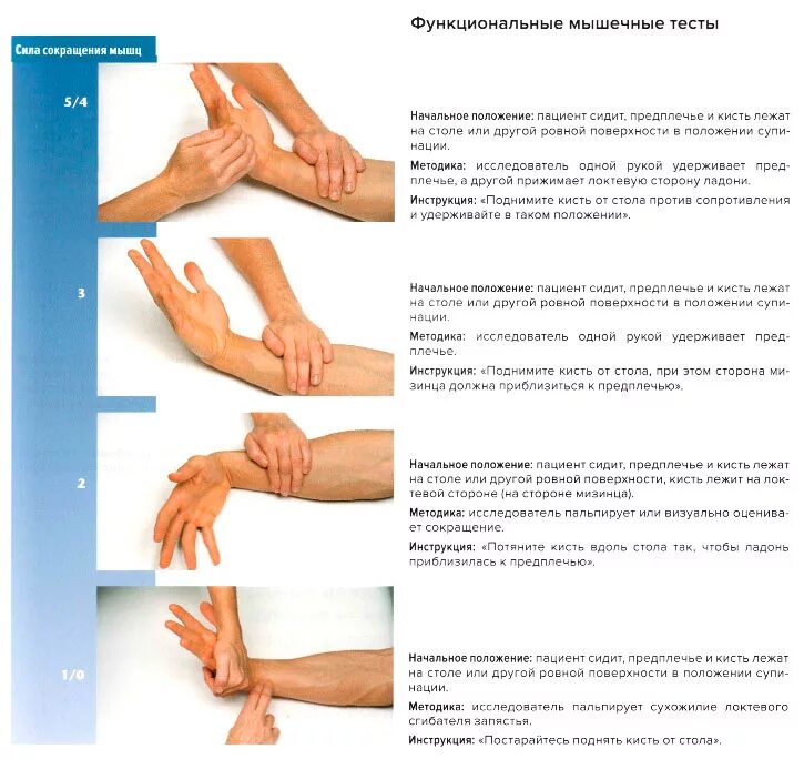 Поперечное сжатие кисти. Тест фалена на туннельный. Тесты для определения силы. Тест кисти. Кисть при поражении срединного нерва.
