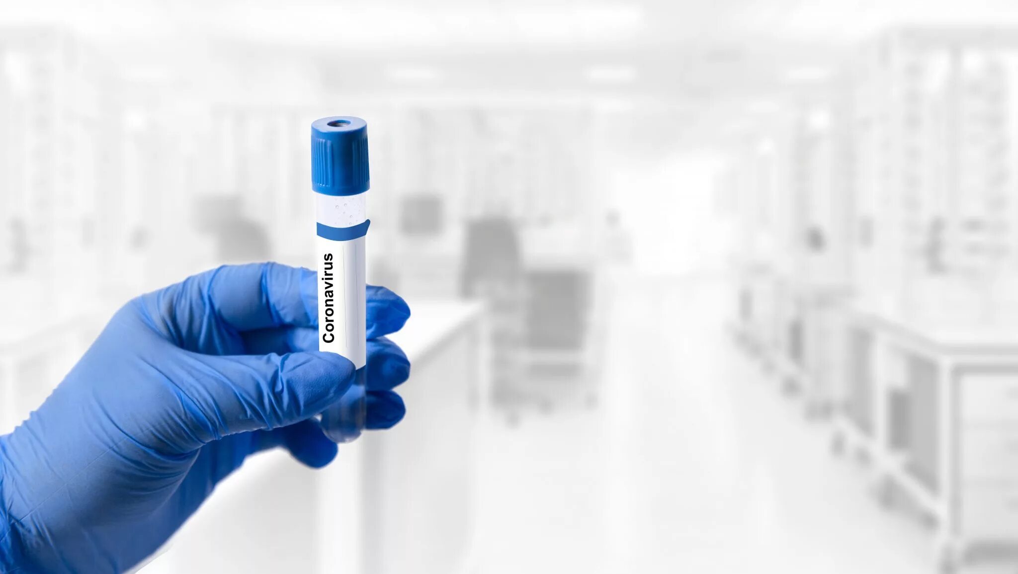 Virus testing