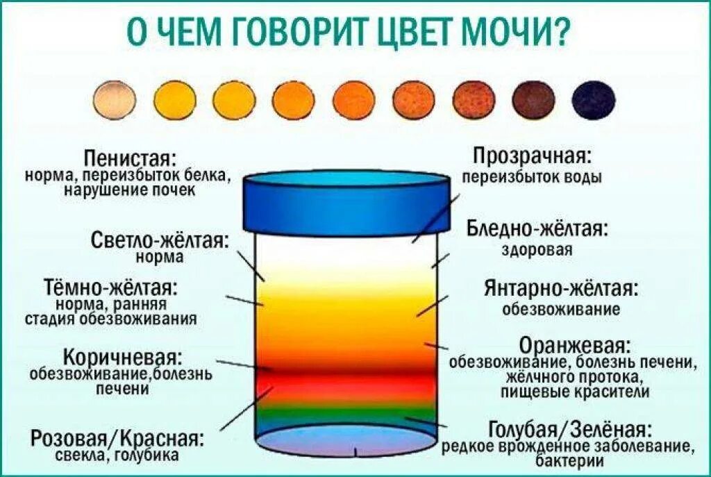 Моча у мужчин. Цвет мочи. Темный цвет мочи. Изменение цвета мочи. Здоровый цвет мочи.