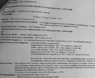 Правая маточная артерия