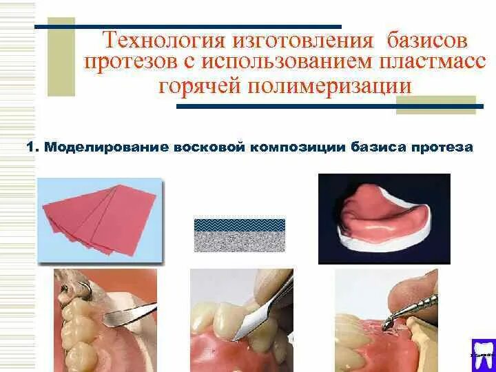 Окончательная моделировка базиса съемного протеза. Предварительная моделировка восковых базисов протеза. Окончательная моделировка базиса частичного съемного протеза. Моделировка базиса для съемных протезов. Методы изготовления протезов