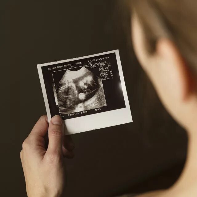 Узи 22 недели. Узи ребенка на 22 неделе беременности. снимок узи. узи плода на 22 неделе беременности.
