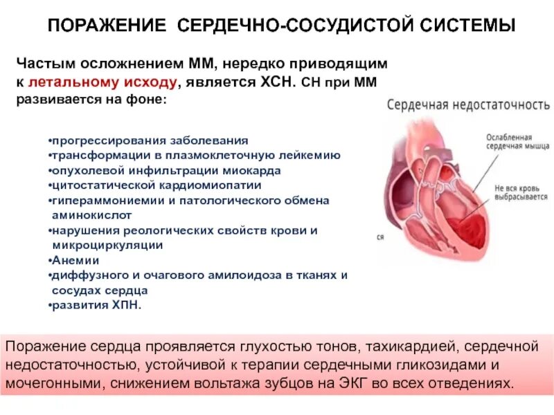 Что делают сердечные мышцы. Ослабление сердечной мышцы. слабая сердечная мышца симптомы. ослабленные мышцы сердца.
