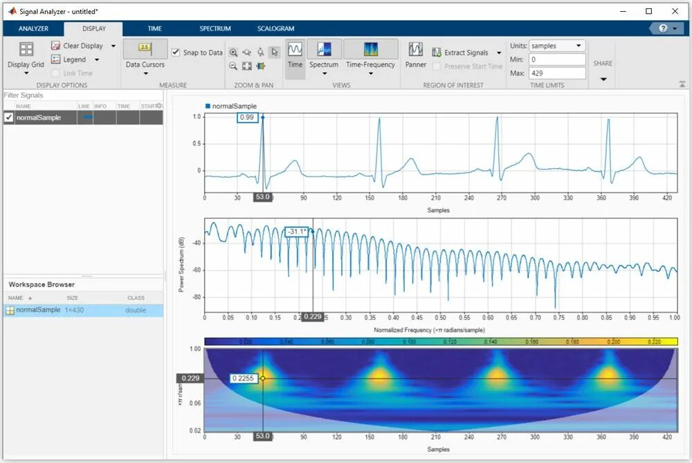 Обработка сигналов matlab. Matlab сигнал. фазоманипулированный сигнал matlab. автокорреляционная функция для дискретного сигнала в матлаб. фазоманипулированный сигнал matlab трехмерный.