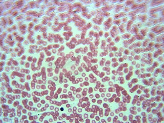 микропрепарат лягушки. микропрепарат крови человека. микропрепарат лягушки. микропрепарат эритроциты лягушки. лейкоциты в крови лягушки строение.