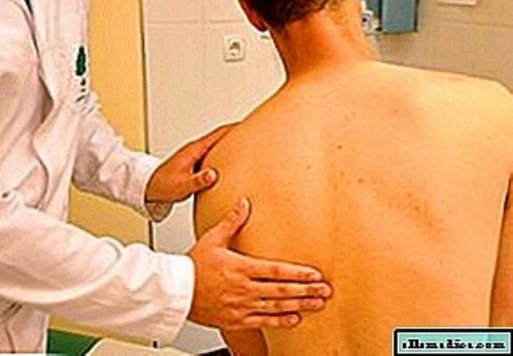 Острая боль под лопаткой. Левая сторона спины. Боль в спине. Болит спина слева под лопаткой. Боль в спине под левой лопаткой.