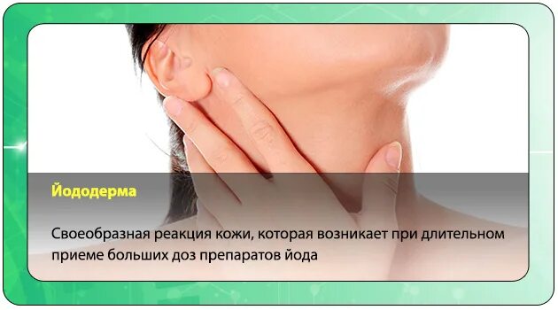 Отравление йодом симптомы. Отравление йодом симптомы