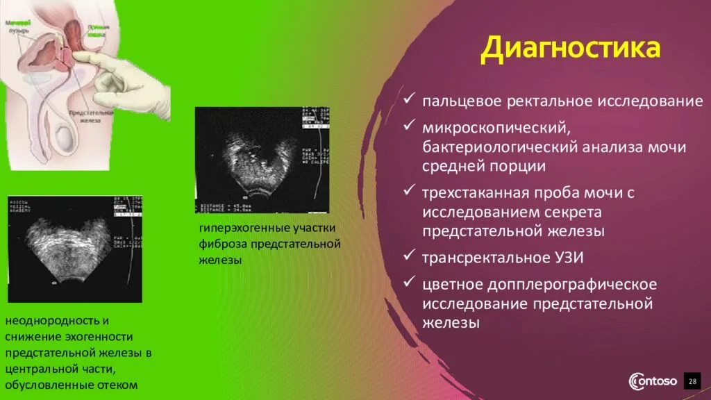 Ректальный анализ. Ректальное исследование предстательной железы. Пальцевое обследование предстательной железы. Пальцевое ректальное исследование простаты. Пальцевое ректальное исследование (при) предстательной железы.