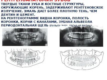 Твердая зубная