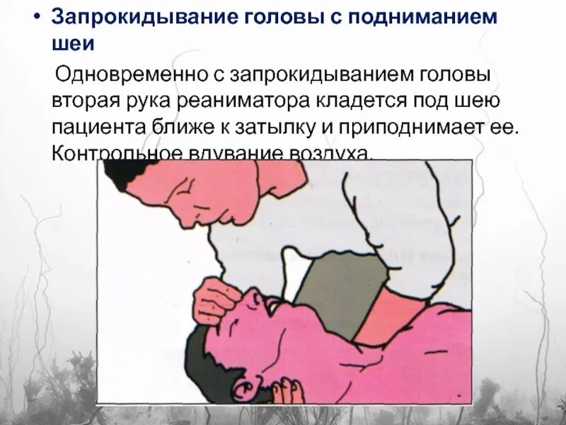 День запрокидывания головы 28 августа картинки. Запрокидывание головы. запрокидывание головы не производится при:. симптом запрокидывания головы. проба с запрокидыванием головы.