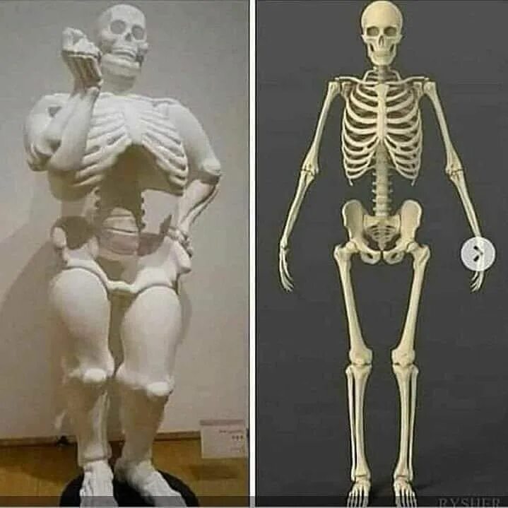 Широкие кости. Скелет с широкой костью. Люди с широкими костями.