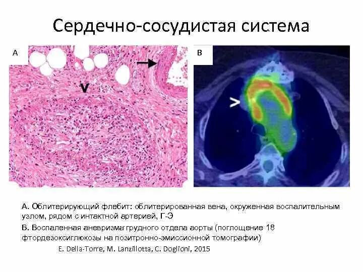 IGG ассоциированные заболевания. Ig 4 ассоциированные заболевания. Igg4 ассоциированные заболевания клинические рекомендации. Igg4-ассоциированный холангит. Иммуноглобулин g4