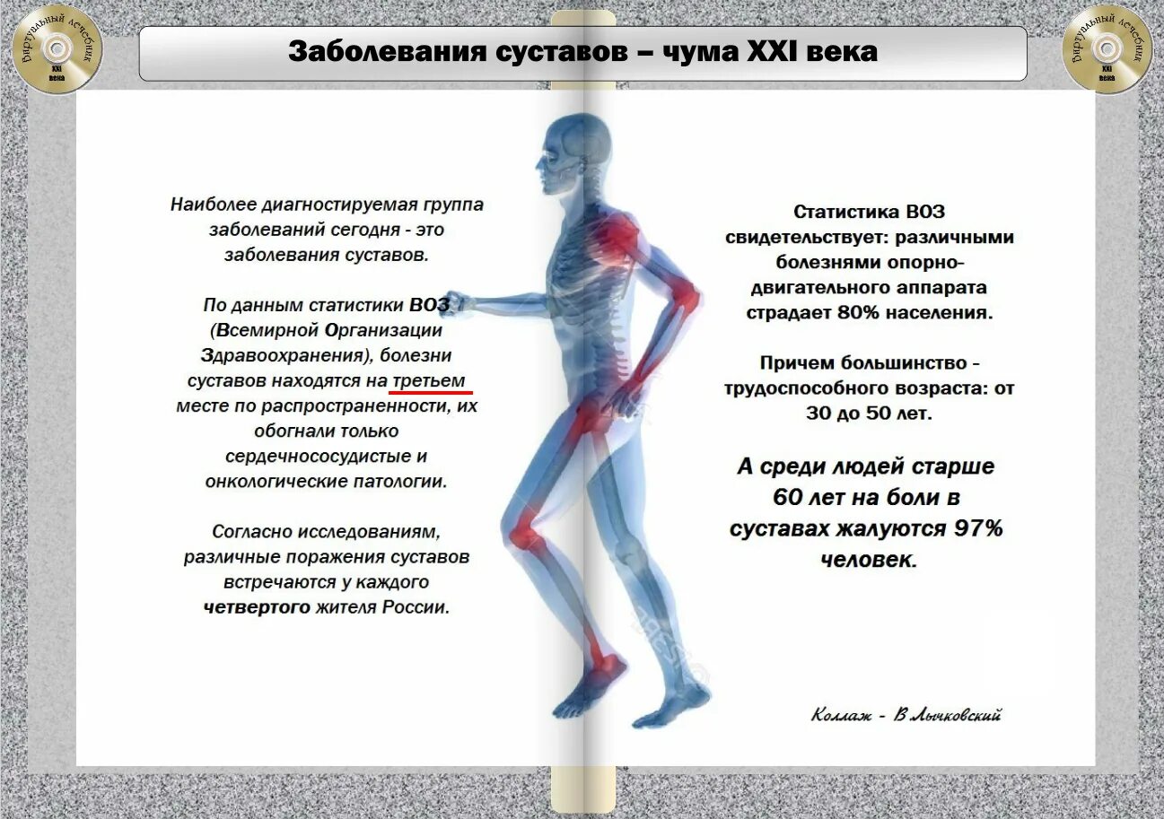 Болезни суставов температура. Статистика заболеваний суставов. Болезни опорно-двигательного аппарата. Профилактика заболеваний суставов. Пациентов с патологиями опорно- двигательного аппарата.